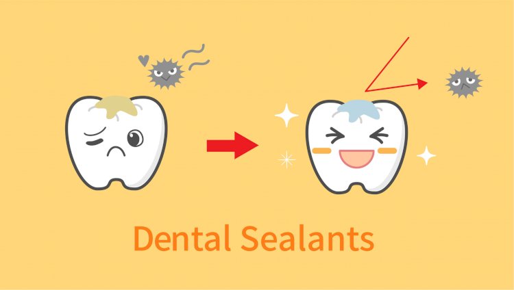 [វីដេអូ] Ep.2 ប្រធានបទ ៖​​ Dental Sealant