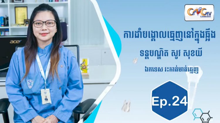 [វីដេអូ] Ep.24 ប្រធានបទ៖ ការដាំបង្គោលធ្មេញនៅក្នុងឆ្អឹង