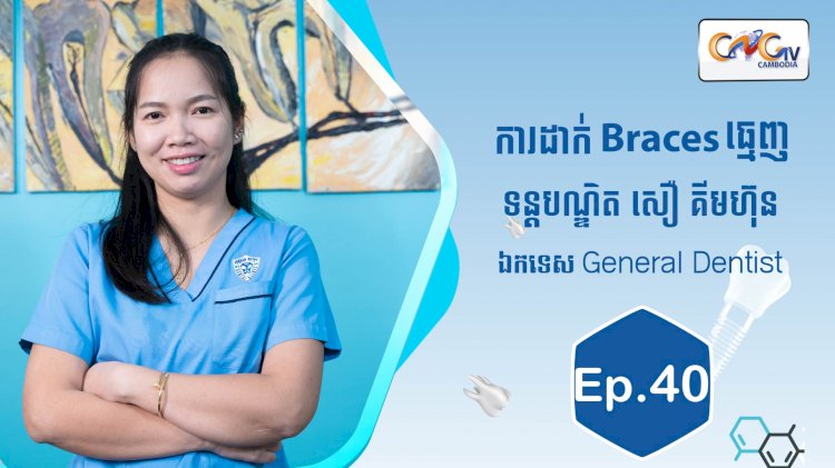 [វីដេអូ] Ep.40 ប្រធានបទ៖   ការដាក់ braces ធ្មេញ