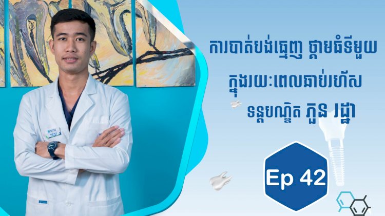 [វីដេអូ] Ep.42 ប្រធានបទ៖  ការបាត់បង់ធ្មេញ ថ្គាមធំទីមួយ