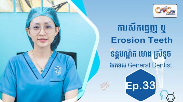 [វីដេអូ] Ep.33 ប្រធានបទ៖ សឹកធ្មេញ ឬ Erosion Teeth