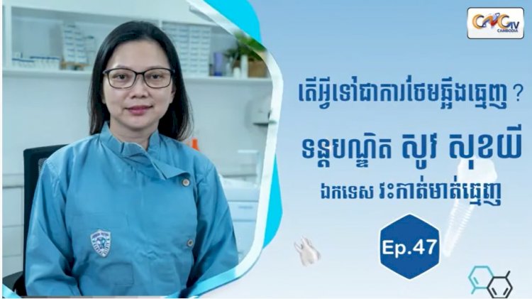 [វីដេអូ] Ep.47 ប្រធានបទ៖ តើអ្វីទៅជាការថែមឆ្អឹងធ្មេញ?