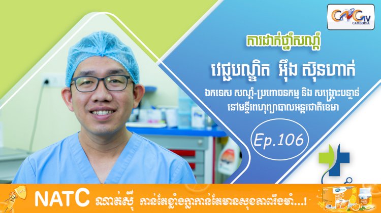 [វីដេអូ] Ep. 106 ប្រធានបទ៖ ការដាក់ថ្នាំសណ្តំ