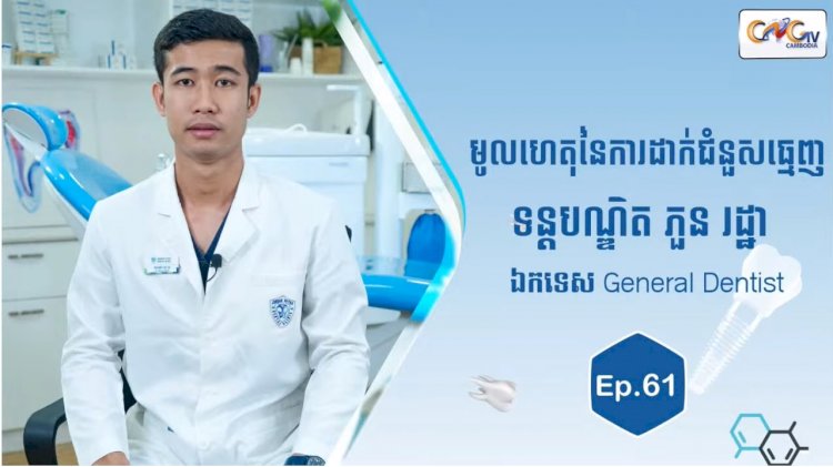 [វីដេអូ] Ep.61 ប្រធានបទ៖ មូលហេតុនៃការដាក់ជំនួសធ្មេញ