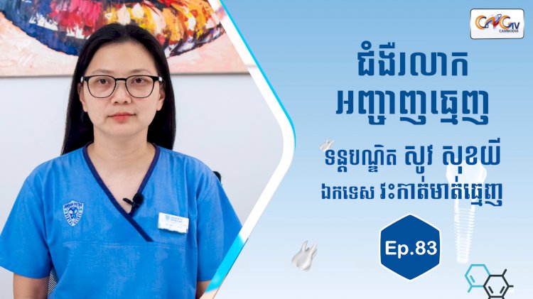 [វីដេអូ] Ep. 83 ប្រធានបទ៖ ជំងឺរលាកអញ្ចាញធ្មេញ