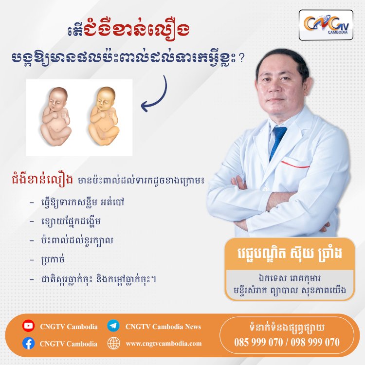 តើជំងឺខាន់លឿង បង្កឪ្យមានផលប៉ះពាល់ដល់ទារកអ្វីខ្លះ ?